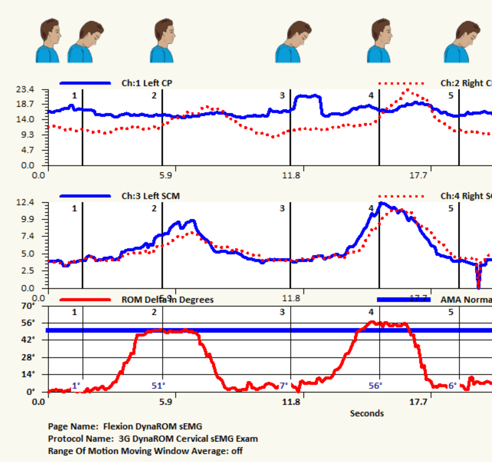 Diet and rheumatoid arthritis